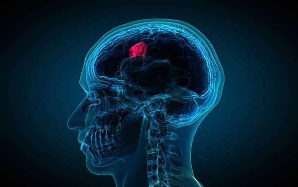Brain Tumor Causes and Treatments